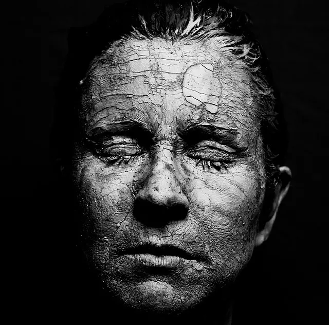 Dry Skin Treatment Toledo,Professional dry skin care,Hydrating facials for dry skin