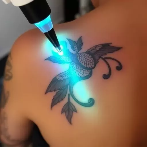 laser tattoo removal toledo,non-laser tattoo removal,tattoo removal technology