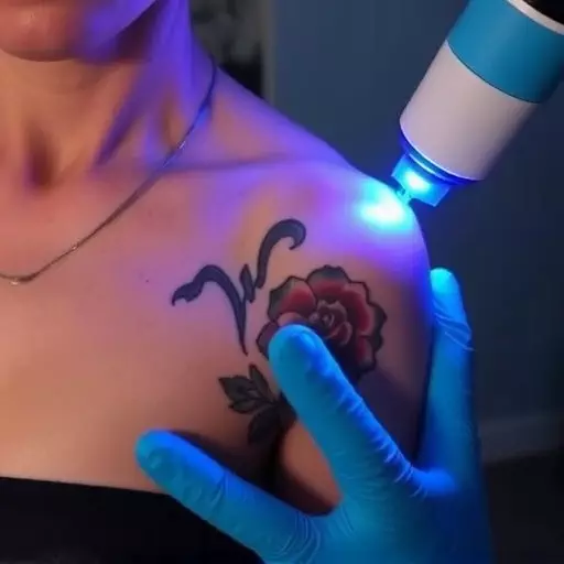 laser tattoo removal toledo,non-laser tattoo removal,tattoo removal technology