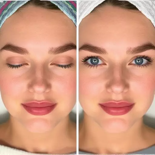 Melasma Treatment Services Toledo,Professional melasma treatments,Non-invasive melasma treatments