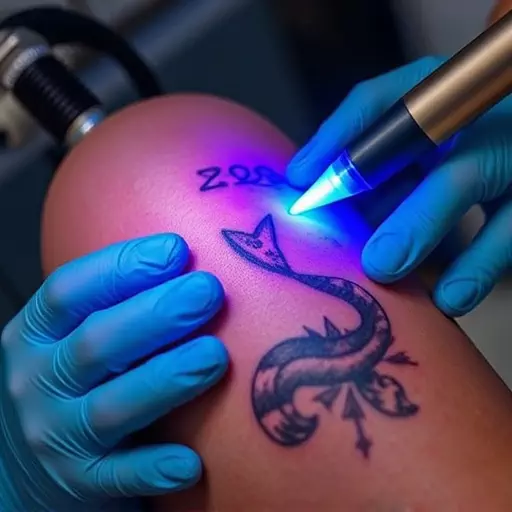 tattoo removal techniques toledo,laser tattoo removal,non-laser tattoo removal methods