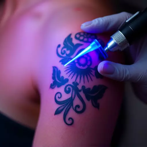 tattoo removal techniques toledo,laser tattoo removal,non-laser tattoo removal methods